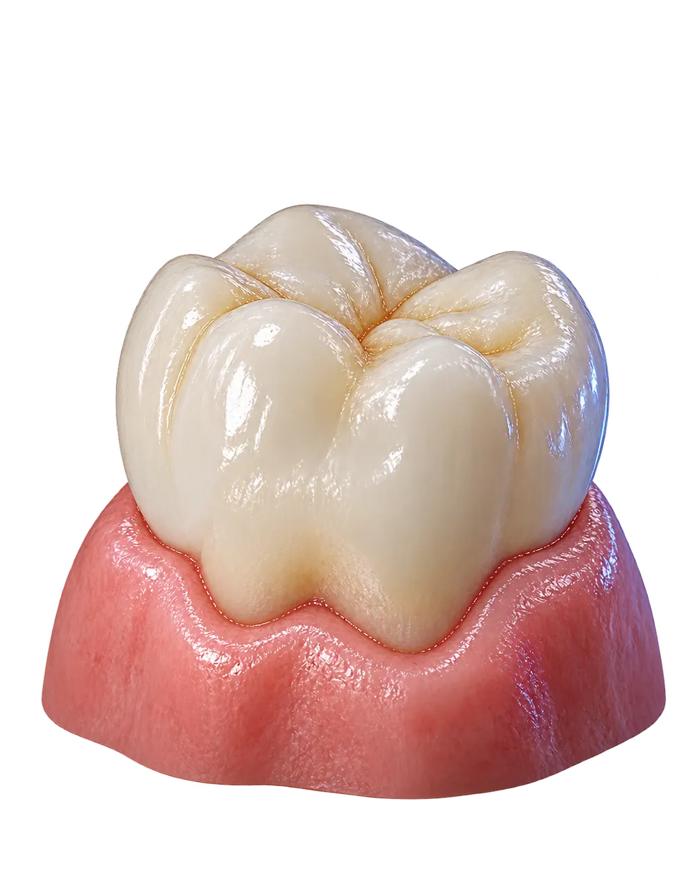 Zirkonyum kaplama konusunu açıklayan temsili dental model