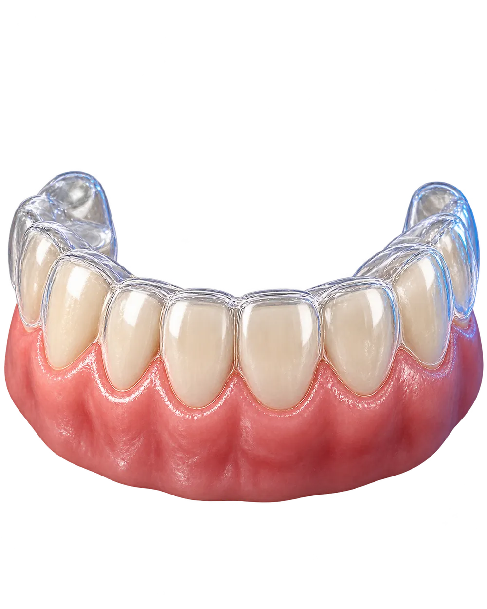 Şeffaf plak tedavisi konusuna ait temsili dental görsel