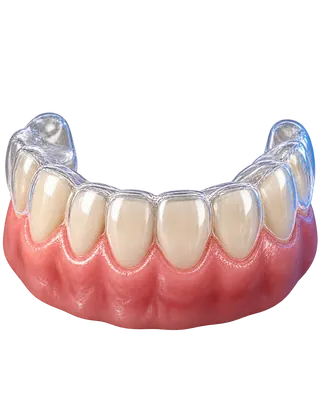 Şeffaf plak tedavisi konusuna ait temsili dental görsel