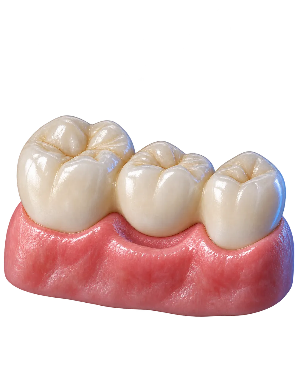 Protez diş tedavileri konusunu açıklayan temsili dental model