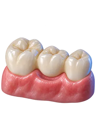 Protez diş tedavileri konusuna ait temsili dental görsel