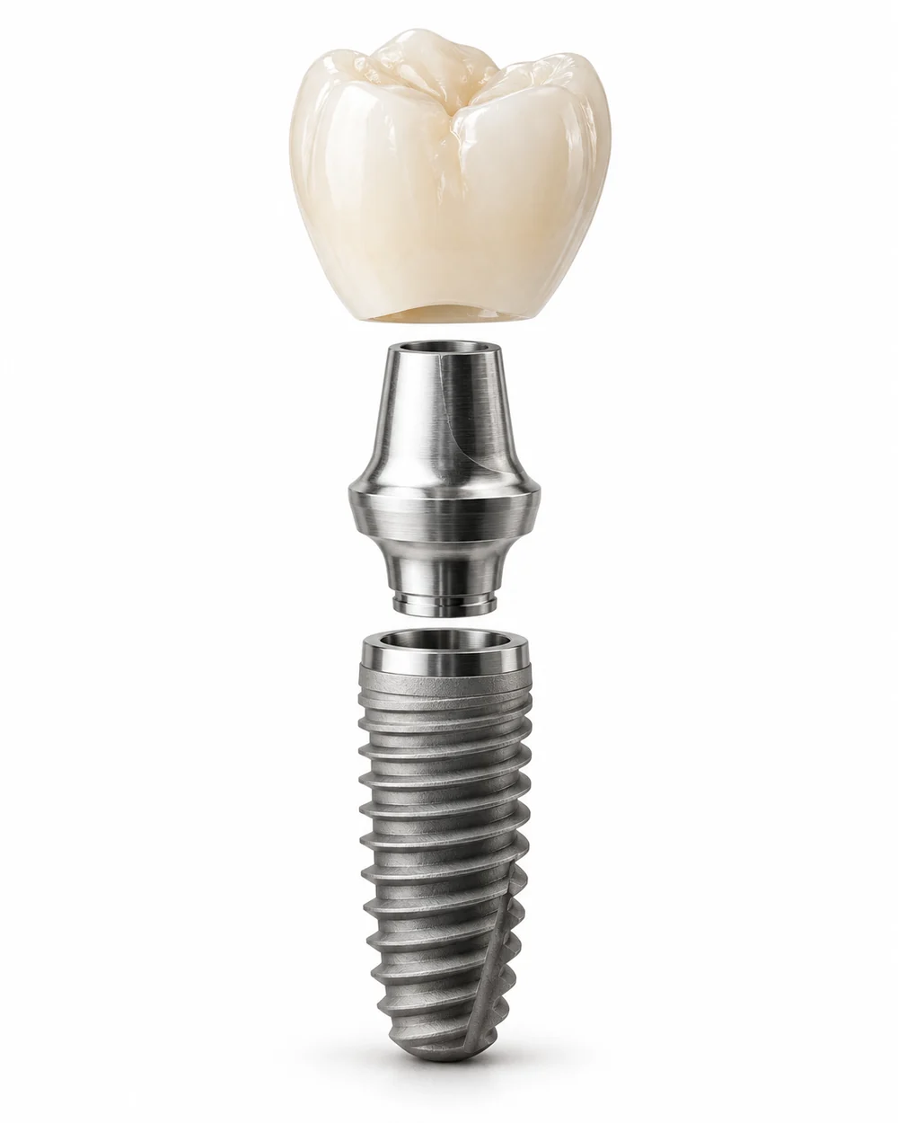 Beyaz zeminde implant gövdesi, bağlantı parçası ve seramik kron bileşenleri