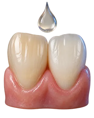 Diş beyazlatma konusuna ait temsili dental görsel